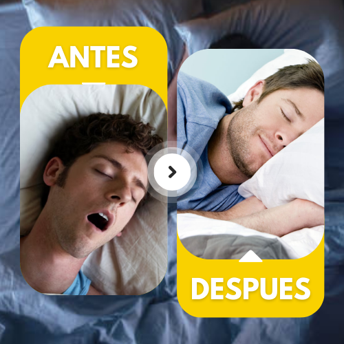 Sueñaliv - Placa Anti Bruxismo y Anti Ronquido